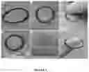 Fig. 04 - Apparatuses and methods for treating ophthalmic diseases and disorders
