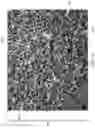 Fig. 07 - Foam structure wound inserts for directional granulation