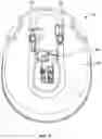 Fig. 04 - Breast pump assembly with remote interface