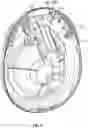 Fig. 06 - Breast pump assembly with remote interface