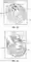Fig. 14 - Breast pump assembly with remote interface