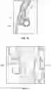 Fig. 18 - Breast pump assembly with remote interface