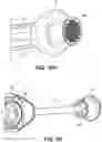 Fig. 15 - Safety syringe