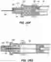 Fig. 38 - Safety syringe