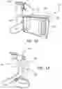 Fig. 11 - Insufflation stabilization system