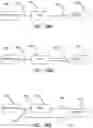 Fig. 15 - Insufflation stabilization system