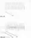 Fig. 17 - Insufflation stabilization system