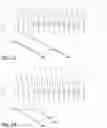 Fig. 18 - Insufflation stabilization system