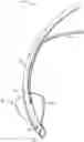 Fig. 01 - Endotracheal cuff and technique for using the same