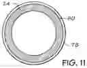 Fig. 09 - Endotracheal cuff and technique for using the same