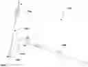 Fig. 01 - Tracheotomy device and method