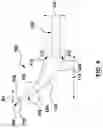 Fig. 04 - Tracheotomy device and method