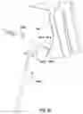 Fig. 16 - Tracheotomy device and method
