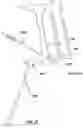 Fig. 17 - Tracheotomy device and method