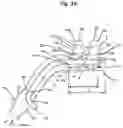 Fig. 03 - Nasal breathing apparatus and method for high-flow therapy and non-invasive ventilation