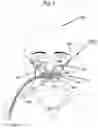 Fig. 09 - Nasal breathing apparatus and method for high-flow therapy and non-invasive ventilation