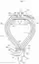 Fig. 15 - Nasal breathing apparatus and method for high-flow therapy and non-invasive ventilation