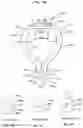 Fig. 17 - Nasal breathing apparatus and method for high-flow therapy and non-invasive ventilation