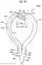 Fig. 18 - Nasal breathing apparatus and method for high-flow therapy and non-invasive ventilation