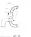 Fig. 09 - Patient interfaces with condensation reducing or compensating arrangements