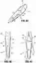 Fig. 06 - Symmetrical tip acute catheter