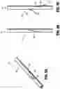 Fig. 09 - Symmetrical tip acute catheter