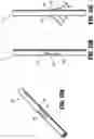 Fig. 10 - Symmetrical tip acute catheter