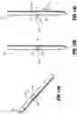 Fig. 14 - Symmetrical tip acute catheter