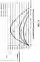 Fig. 03 - Multi-lumen catheter with enhanced flow features