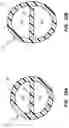 Fig. 09 - Multi-lumen catheter with enhanced flow features