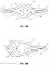Fig. 10 - Multi-lumen catheter with enhanced flow features