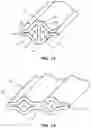 Fig. 12 - Multi-lumen catheter with enhanced flow features