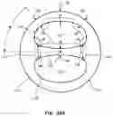 Fig. 14 - Multi-lumen catheter with enhanced flow features