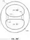 Fig. 16 - Multi-lumen catheter with enhanced flow features
