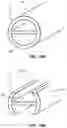Fig. 19 - Multi-lumen catheter with enhanced flow features