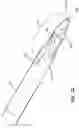 Fig. 22 - Multi-lumen catheter with enhanced flow features
