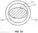 Fig. 23 - Multi-lumen catheter with enhanced flow features
