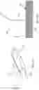 Fig. 12 - Fistula formation devices and methods therefor