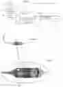 Fig. 02 - Controlled bending for catheters