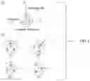 Fig. 03 - Controlled bending for catheters