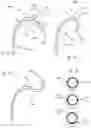 Fig. 09 - Medical tool positioning devices, systems, and methods of use and manufacture