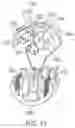 Fig. 18 - Medical device control handle with multiple puller wires