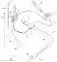 Fig. 01 - System for its use in the treatment of vascular stenosis and occlusions