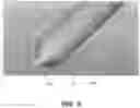Fig. 05 - BALLOON WITHIN BALLOON CATHETER SYSTEM AND METHODS OF USE
