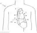 Fig. 01 - Blood clot removal device, system, and method