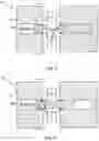 Fig. 04 - Blood clot removal device, system, and method