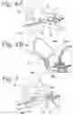 Fig. 05 - Foam applicator for in-ear use