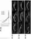 Fig. 20 - Targeted drug delivery methods using a microneedle