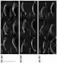 Fig. 21 - Targeted drug delivery methods using a microneedle