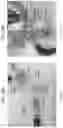 Fig. 30 - Targeted drug delivery methods using a microneedle
